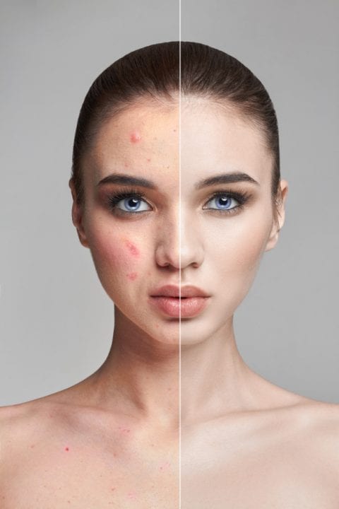 How To Deal With A Bad Skin Day Medifine Skin Clinic